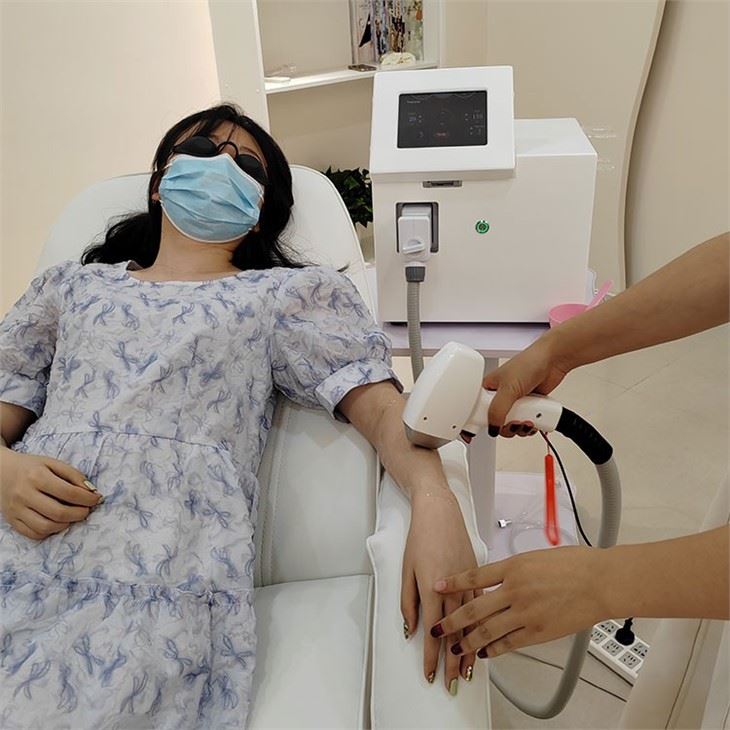 Portable Laser Hair Removal Machine