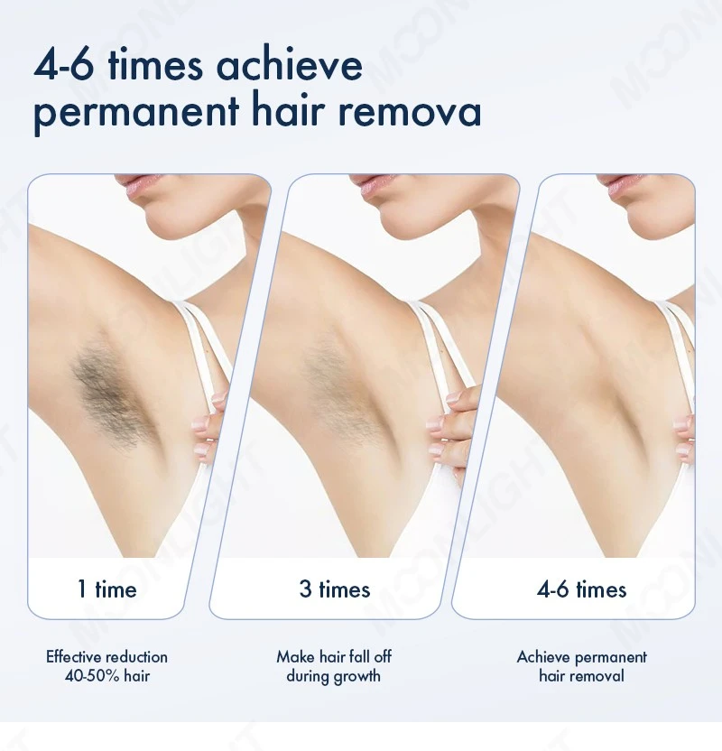 2 in 1 ND YAG + Diode Laser Hair Removal Machine