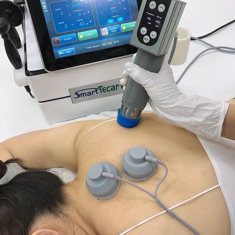 Smart Tecar Wave System price