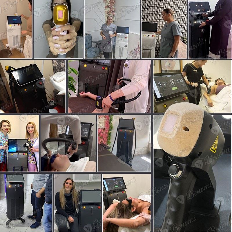 Wholesale Ice Titanium Diode Laser Hair Removal Machine